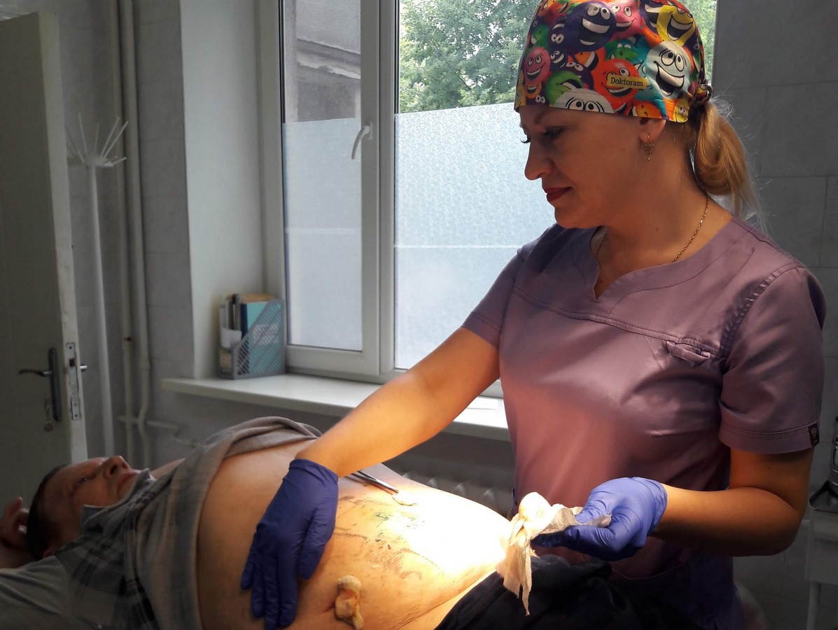 Операційна у госпіталі як лінія фронту: тут воюють за життя і перемагають!