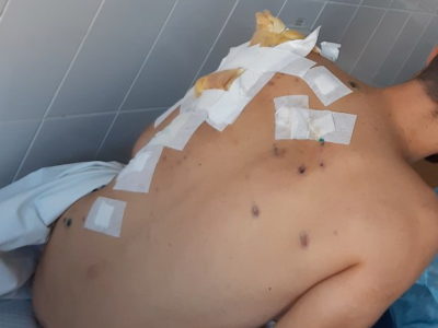 Противник застосував снаряди з уражальними елементами різної структури  