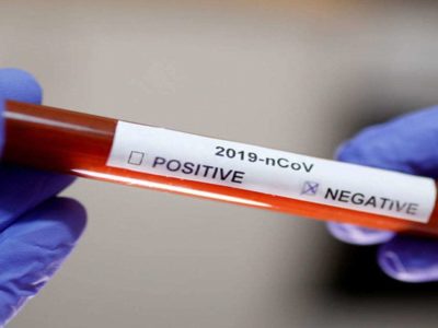 За результатами лабораторних досліджень у військового пенсіонера коронавірус не виявлено  