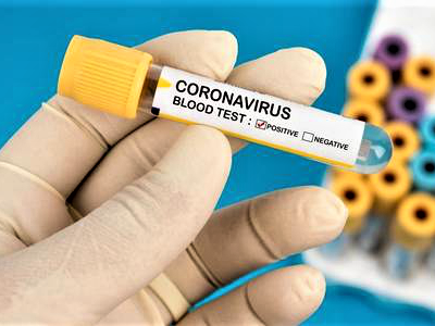 Військові медики забезпечені швидкими тестами на виявлення коронавірусу  