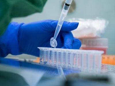 В Україні зможуть робити до 80 тисяч ПЛР-тестів щотижня – Ляшко  