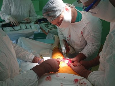 У Львівському госпіталі за допомогою новітніх технологій відновлено довжину кінцівок пацієнта  