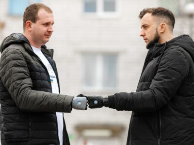 Двом українським захисникам встановили сучасні високотехнологічні біонічні протези  