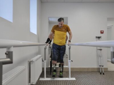 Після унікальної операції зі вживленням у кістку протеза військовий почав ходити  