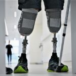 Остеоінтеграційне протезування: плюси та мінуси