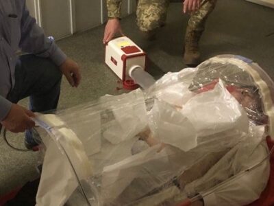 «Надувний кокон довкола людини»: Віктор Трегубов про «операційні в наплічнику»  