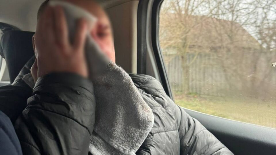 Четверо людей було поранено на Сумщині внаслідок російських обстрілів  