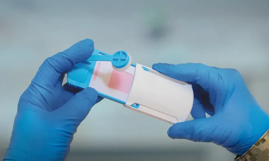 Як здійснюється відбір ДНК-зразків у військових: роз’яснення від Міноборони  