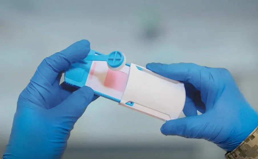 Як здійснюється відбір ДНК-зразків у військових: роз’яснення від Міноборони